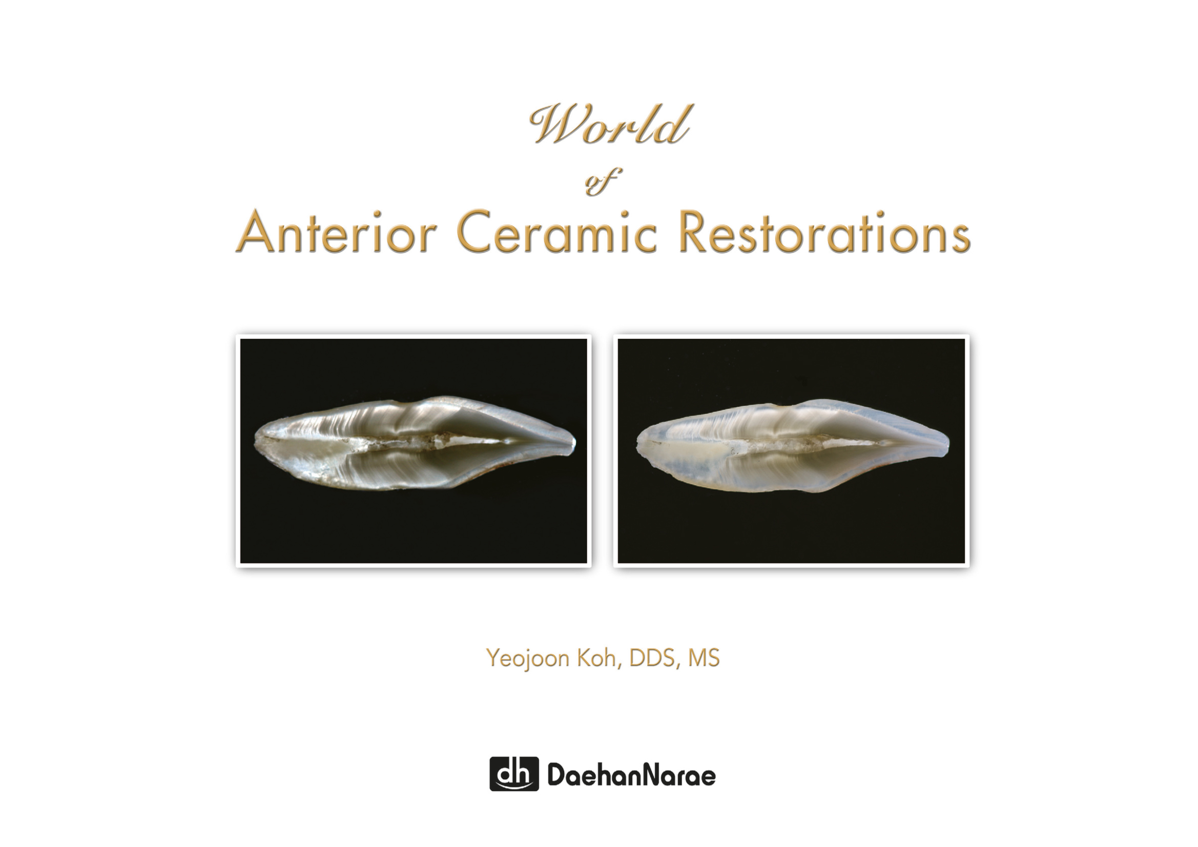 World of Anterior Ceramic Restorations